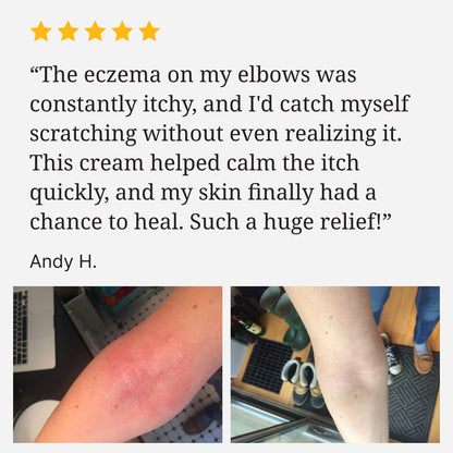 Smiles & Joys Eczema and Psoriasis Herbal Cream