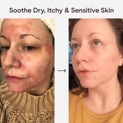 East Asia Herbal Skin Soothing Cream AU