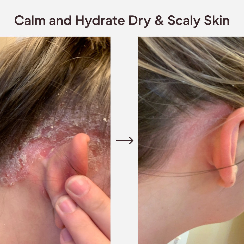 East Asia Herbal Skin Soothing Cream AU