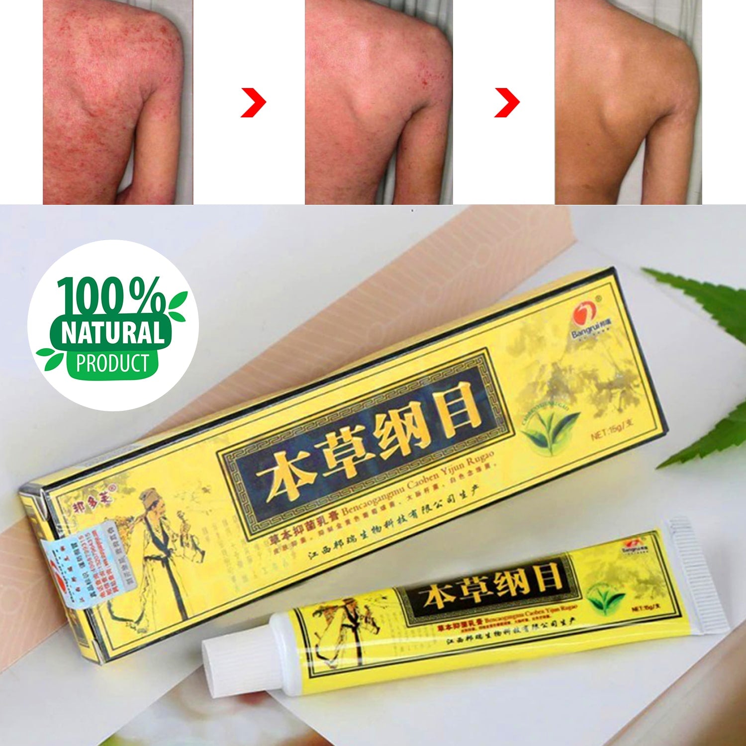 Original Advanced Psoriasis & Eczema Natural Herbal Cream